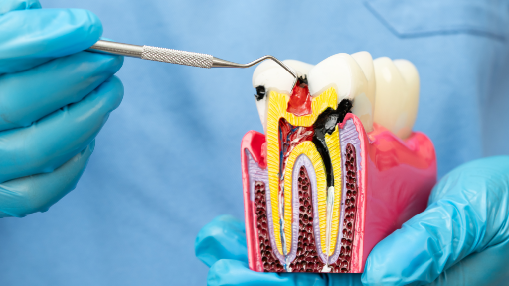dentist holding a model of a tooth and its roots